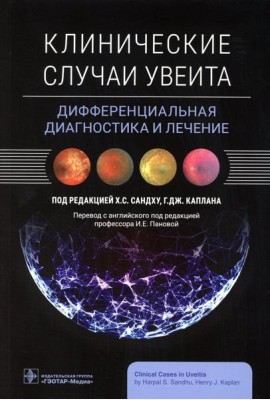 Клинические случаи увеита. Дифференциальная диагностика и лечение