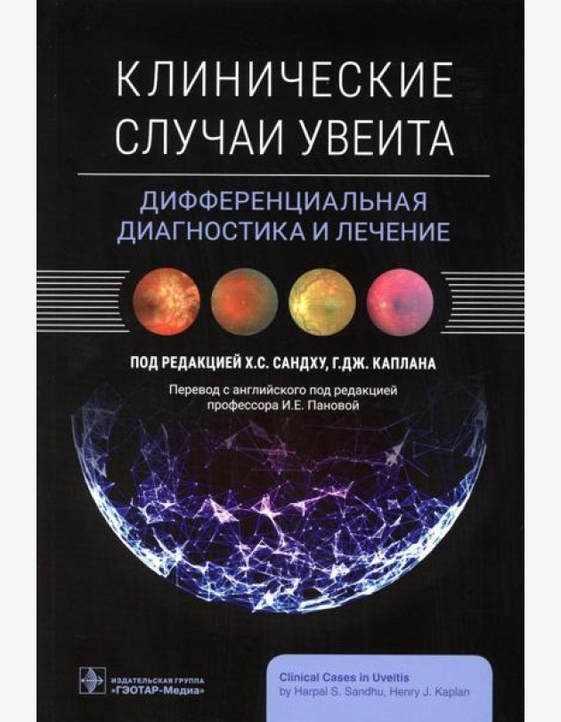 Клинические случаи увеита. Дифференциальная диагностика и лечение