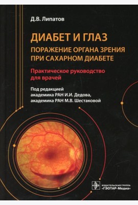 Диабет и глаз. Поражение органа зрения при сахарном диабете: практическое руководство для врачей