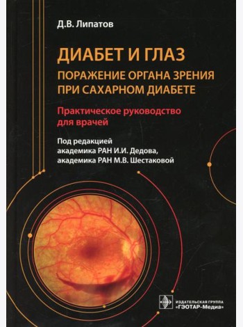 Диабет и глаз. Поражение органа зрения при сахарном диабете: практическое руководство для врачей