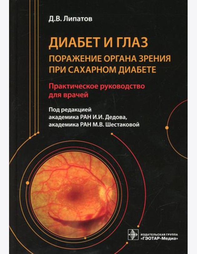 Диабет и глаз. Поражение органа зрения при сахарном диабете: практическое руководство для врачей