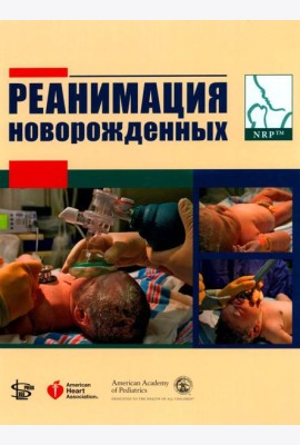 Реанимация новорожденных