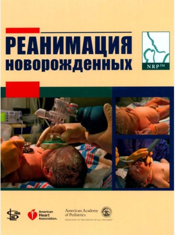 Реанимация новорожденных
