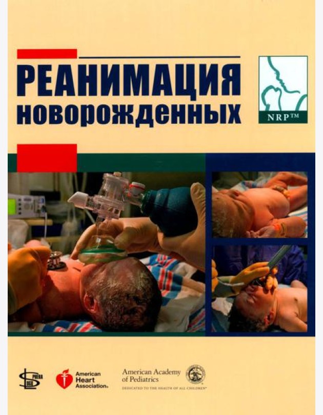 Реанимация новорожденных