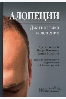 Алопеции. Диагностика и лечение