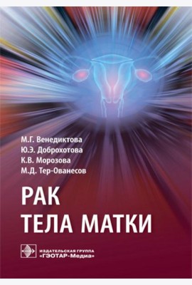 Рак тела матки