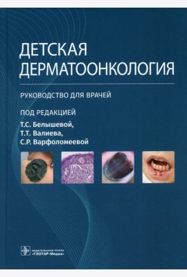 Детская дерматоонкология: руководство для врачей