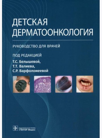 Детская дерматоонкология: руководство для врачей