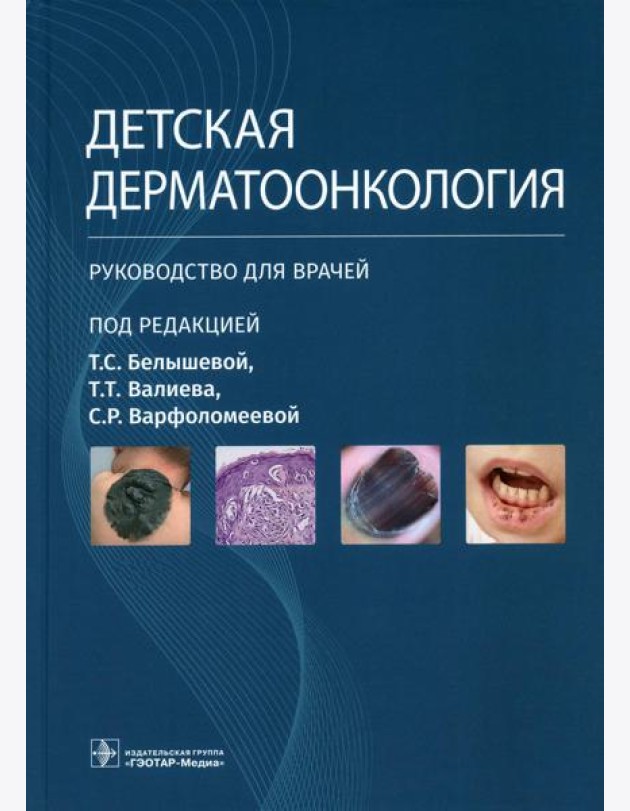 Детская дерматоонкология: руководство для врачей