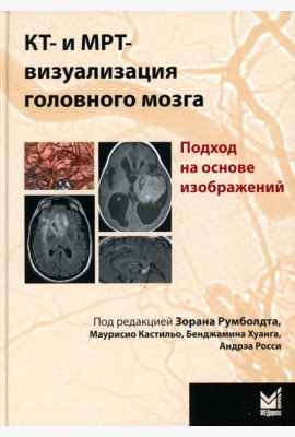 КТ- и МРТ- визуализация головного мозга. Подход на основе изображений. 2-е изд