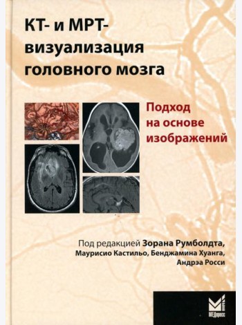 КТ- и МРТ- визуализация головного мозга. Подход на основе изображений. 2-е изд