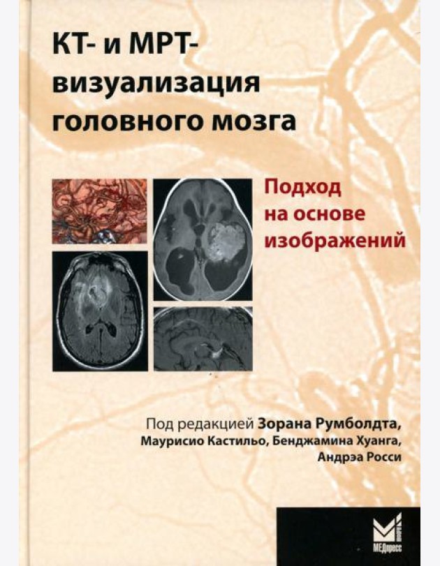КТ- и МРТ- визуализация головного мозга. Подход на основе изображений. 2-е изд