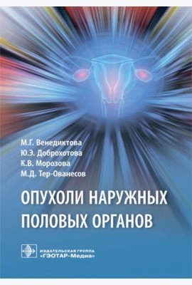 Опухоли наружных половых органов