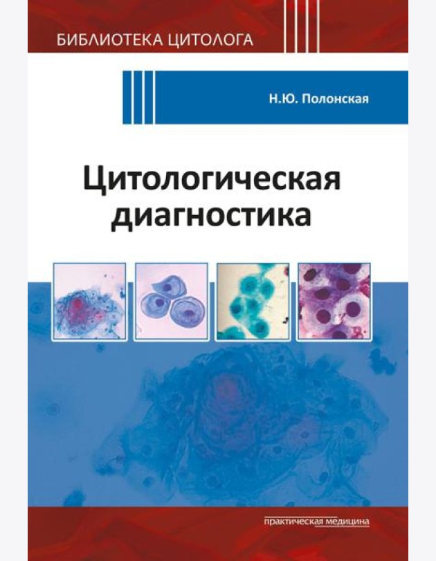 Цитологическая диагностика