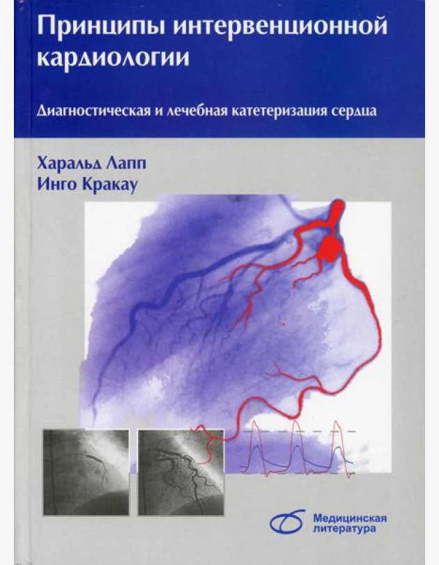 Принципы интервенционной кардиологии. Диагностическая и лечебная катетеризация сердца