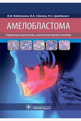 Амелобластома: современная диагностика, клиническая картина и лечение