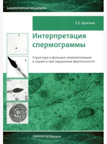 Интерпретация спермограммы. Структура и функция сперматозоидов в норме и при нарушении фертильности