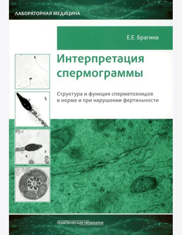 Интерпретация спермограммы. Структура и функция сперматозоидов в норме и при нарушении фертильности