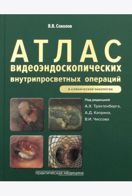 Атлас видеоэндоскопических внутрипросветных операций в клинической онкологии
