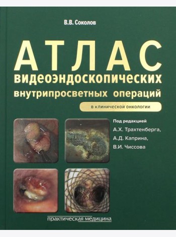 Атлас видеоэндоскопических внутрипросветных операций в клинической онкологии