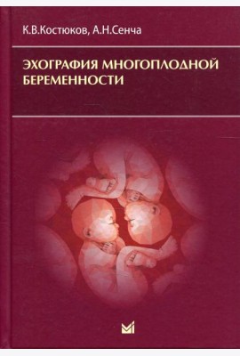 Эхография многоплодной беременности
