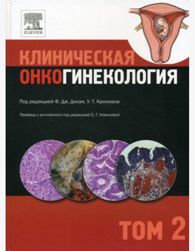 Клиническая онкогинекология. В 3 т. Т. 2
