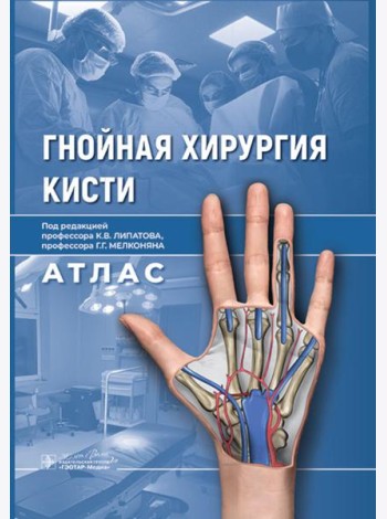 Гнойная хирургия кисти. Атлас
