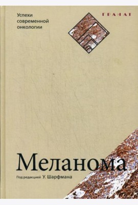 Меланома. Успехи современной онкологии