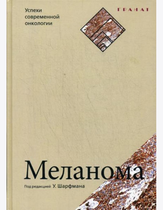 Меланома. Успехи современной онкологии