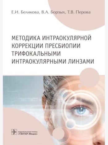 Методика интраокулярной коррекции пресбиопии трифокальными интраокулярными линзами: Учебное пособие