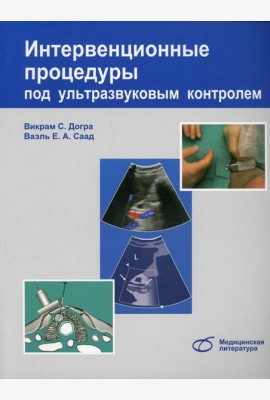 Интервенционные процедуры под ультразвуковым контролем