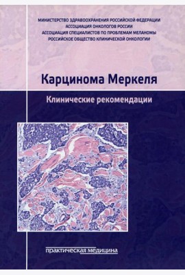 Карцинома Меркеля. Клинические рекомендации