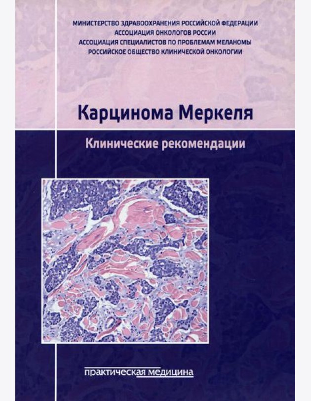 Карцинома Меркеля. Клинические рекомендации