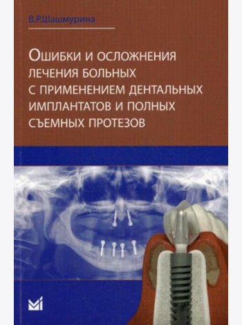 Ошибки и осложнения лечения больных с применением дентальных имплантов и полных съемных протезов