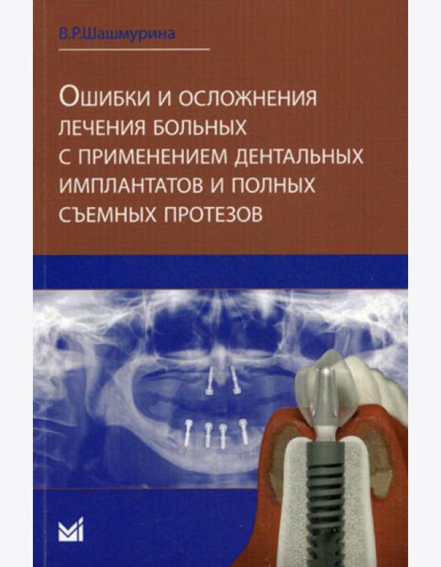Ошибки и осложнения лечения больных с применением дентальных имплантов и полных съемных протезов