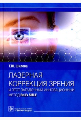 Лазерная коррекция зрения и этот загадочный инновационный метод ReLEx SMILE