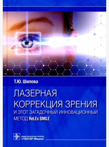 Лазерная коррекция зрения и этот загадочный инновационный метод ReLEx SMILE