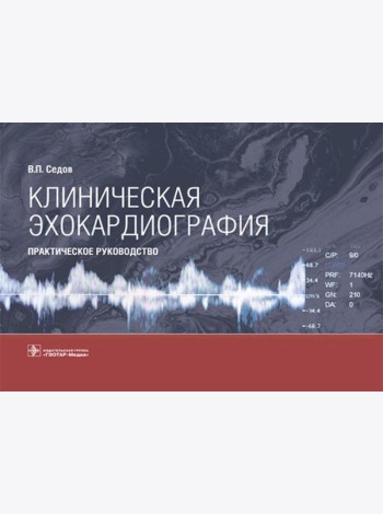 Клиническая эхокардиография: практическое руководство