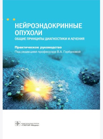 Нейроэндокринные опухоли. Общие принципы диагностики и лечения : практическое руководство