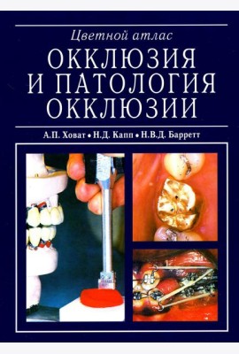 Окклюзия и патология окклюзии. Цветной атлас