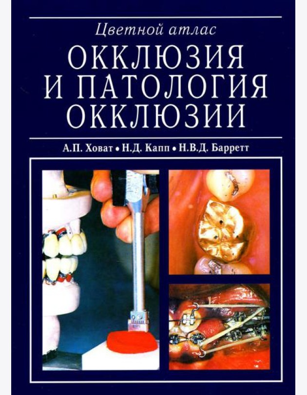 Окклюзия и патология окклюзии. Цветной атлас