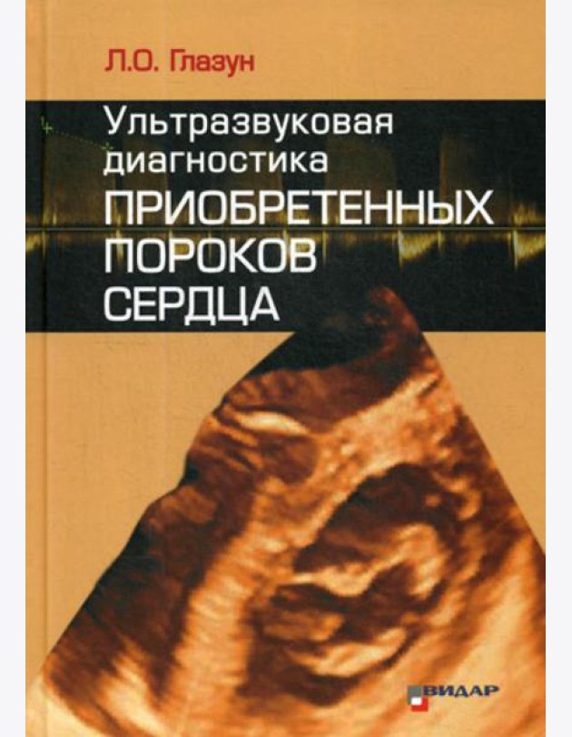 Ультразвуковая диагностика приобретенных пороков сердца