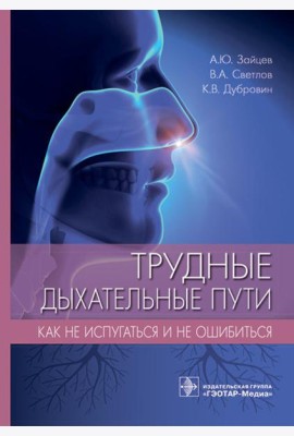 Трудные дыхательные пути. Как не испугаться и не ошибиться
