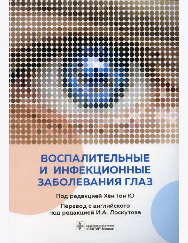 Воспалительные и инфекционные заболевания глаз