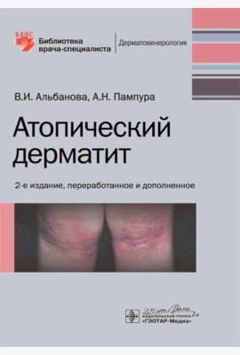 Атопический дерматит. 2-е изд., перераб. и доп