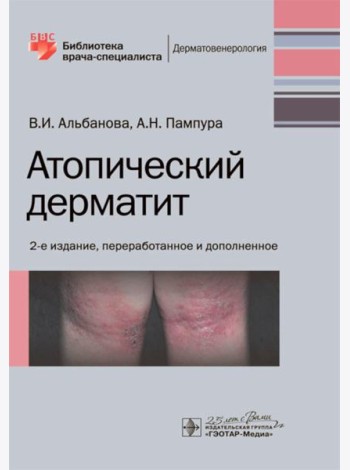 Атопический дерматит. 2-е изд., перераб. и доп