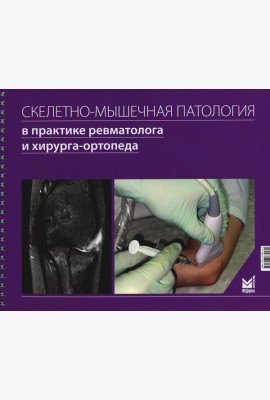 Скелетно-мышечная патология в практике ревматолога и хирурга-ортопеда: Краткое иллюстрированное руководство