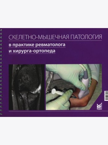 Скелетно-мышечная патология в практике ревматолога и хирурга-ортопеда: Краткое иллюстрированное руководство