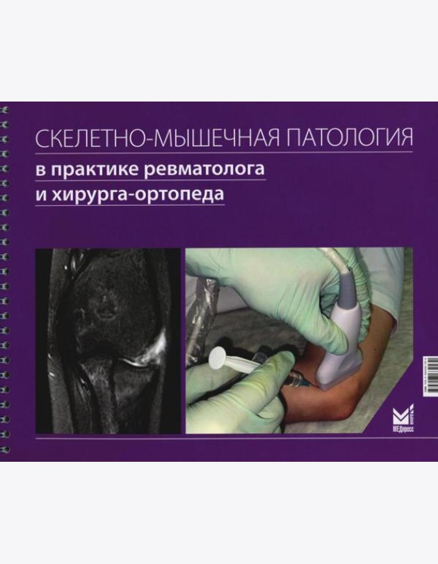 Скелетно-мышечная патология в практике ревматолога и хирурга-ортопеда: Краткое иллюстрированное руководство