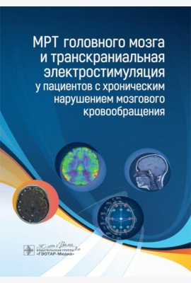 МРТ головного мозга и транскраниальная электростимуляция у пациентов с хроническим нарушением мозгового кровообращения
